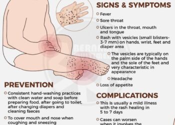 13 cases of foot-hand-mouth disease detected in Kashmir so far: Director Health