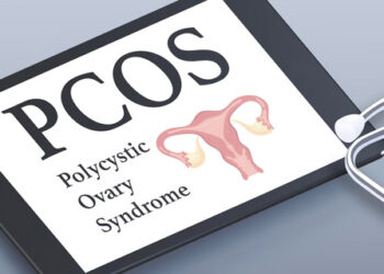 PCOS in teenage girls: Identifying sign and symptoms, lifestyle and dietary tips
